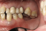 Why Teamwork Matters: The Key to Exceptional Dental Care emphasizes collaboration, communication, and patient-focused outcomes in dental practices.