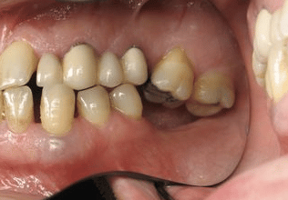 Why Teamwork Matters: The Key to Exceptional Dental Care emphasizes collaboration, communication, and patient-focused outcomes in dental practices.