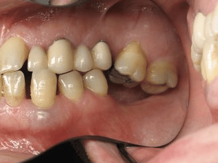 Why Teamwork Matters: The Key to Exceptional Dental Care emphasizes collaboration, communication, and patient-focused outcomes in dental practices.